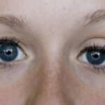 Seeing Is Believing: Ptosis vs. Blepharoplasty