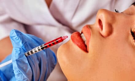 FDA Warns of Delayed Onset Inflammation Near Dermal Filler Sites