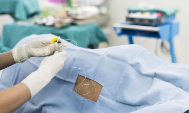 Starting Epidural Infusions in Operating Room Improves Pain Control