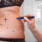Aesthetic Procedures Up, Data Shows