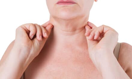 Neck Lifts and Setting Realistic Patient Expectations