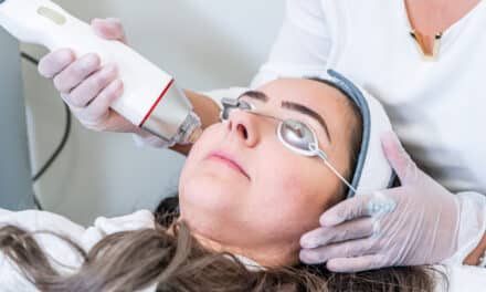 Microneedling Shown to Improve Early-stage Postsurgical Scars