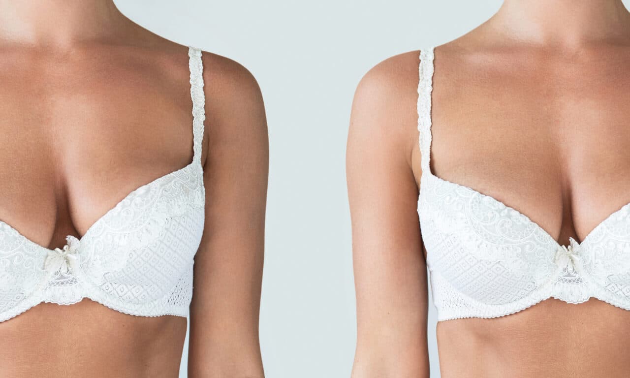 Neural Network Enables Objective Assessment of Breast Symmetry