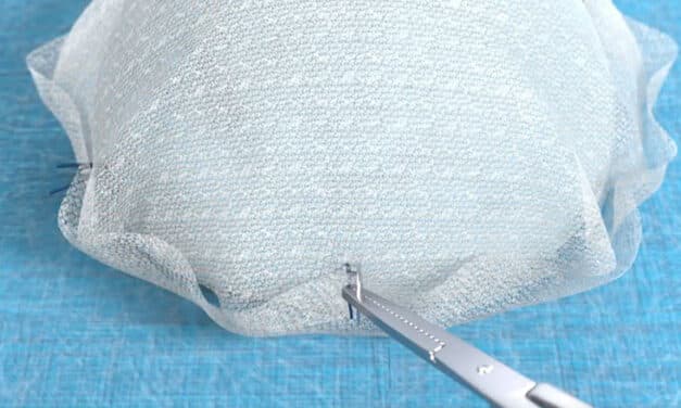 BD Begins Clinical Trial for GalaFLEX LITE Scaffold in Breast Revision Surgery