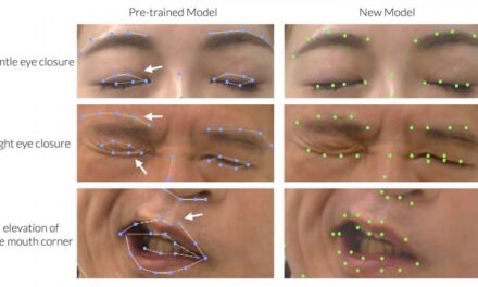AI Tool Enables Automated Evaluation of Facial Palsy