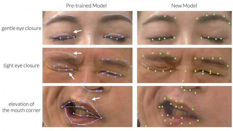 AI Tool Enables Automated Evaluation of Facial Palsy
