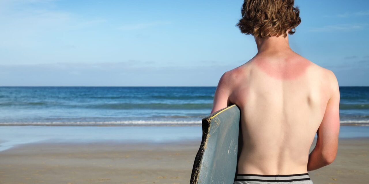 Survey Shows More Americans Are Getting Sunburned