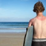 Survey Shows More Americans Are Getting Sunburned
