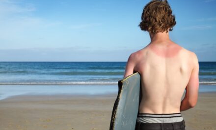 Survey Shows More Americans Are Getting Sunburned
