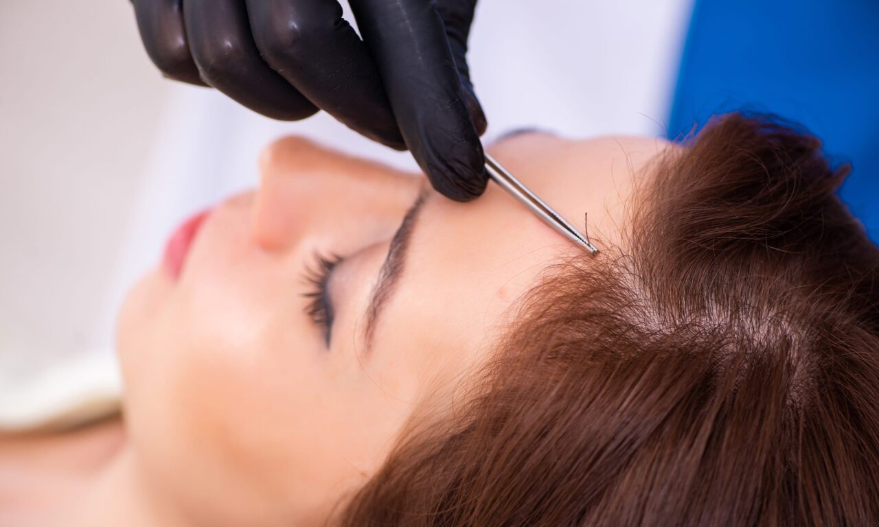 First-time Hair Restoration Patients Shift Younger in 2024, with 95% Under Age 35