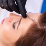 First-time Hair Restoration Patients Shift Younger in 2024, with 95% Under Age 35