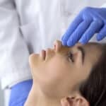 Why Patient Education Matters in Revision Rhinoplasty