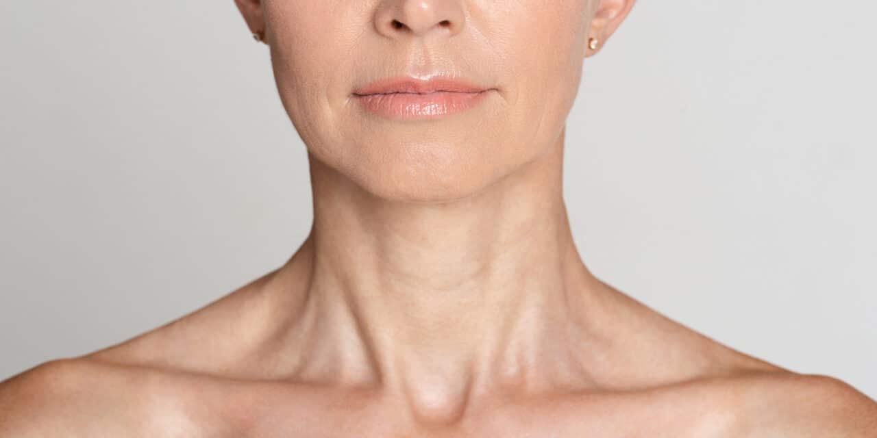 Health Canada Approves Radiesse for Décolleté Wrinkles
