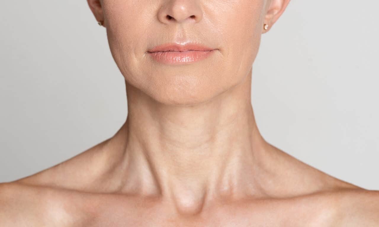 Health Canada Approves Radiesse for Décolleté Wrinkles