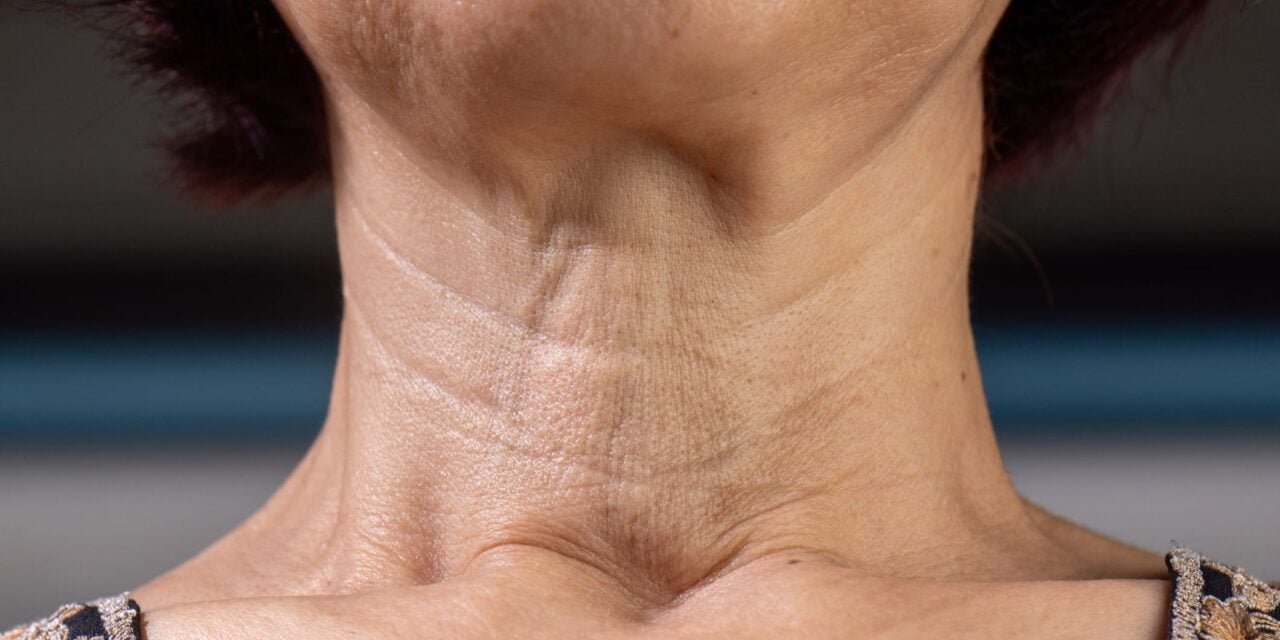 Skinvive by Juvéderm Targets Neck Lines in New FDA Filing