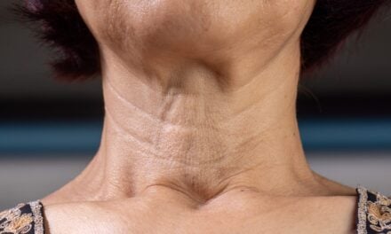 Skinvive by Juvéderm Targets Neck Lines in New FDA Filing