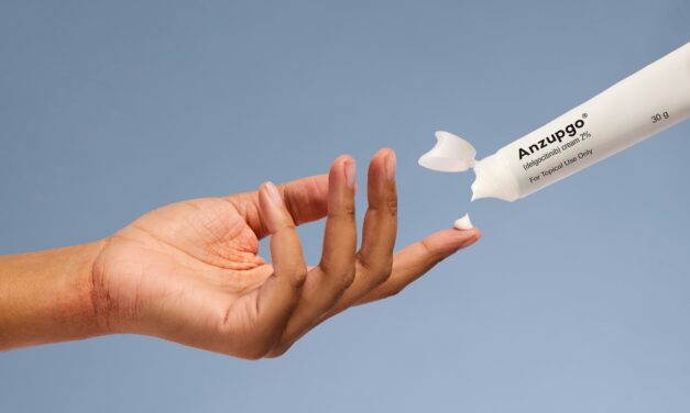 FDA Approves Treatment for Moderate-to-Severe Chronic Hand Eczema