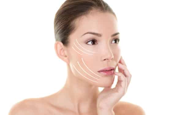 Why Younger Patients Are Choosing the Endoscopic Midface Lift