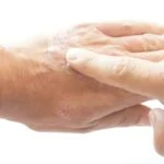 AAD Issues Strong Recommendations for Four Therapies in Updated Atopic Dermatitis Guidelines