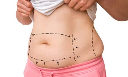 Supporting the Post-Weight Loss Patient: Financing, Follow-Up, and Comprehensive Care