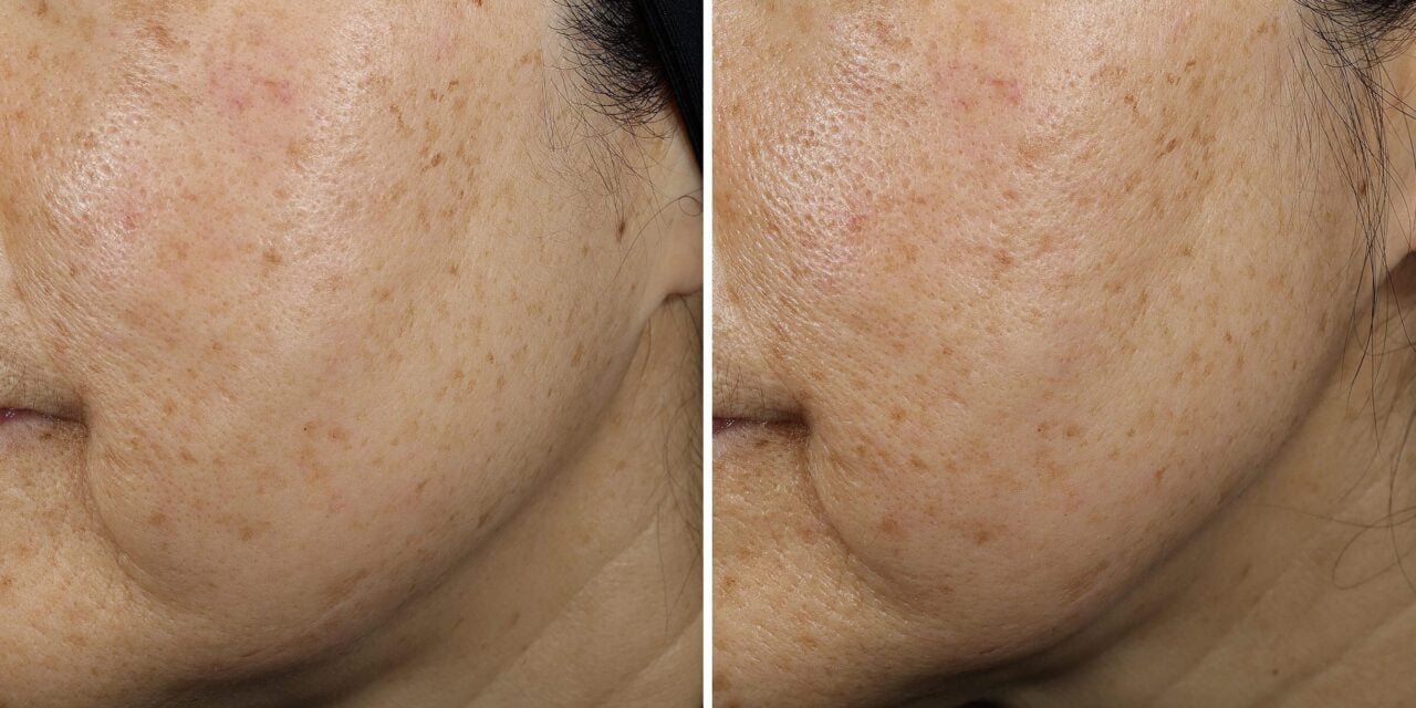 New Serum Targets Sagging Skin with Clinically Backed Results