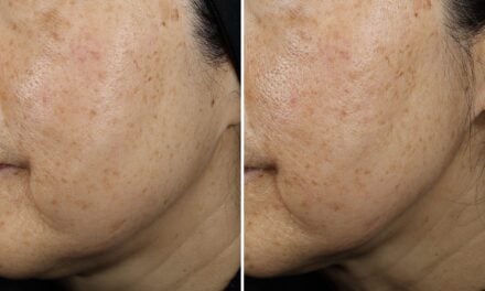 New Serum Targets Sagging Skin with Clinically Backed Results