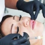 Campaign Launches to Educate on HA Injectable Fillers