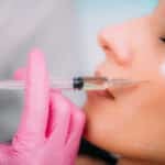 Study Links 3D Volume Measurements with Patient Satisfaction After HA Fillers