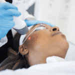 Cutera Announces New Global Initiative Celebrating Laser Aesthetics