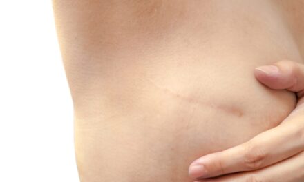 Proposed Bill Aims to Strengthen Insurance Protections for Breast Reconstruction