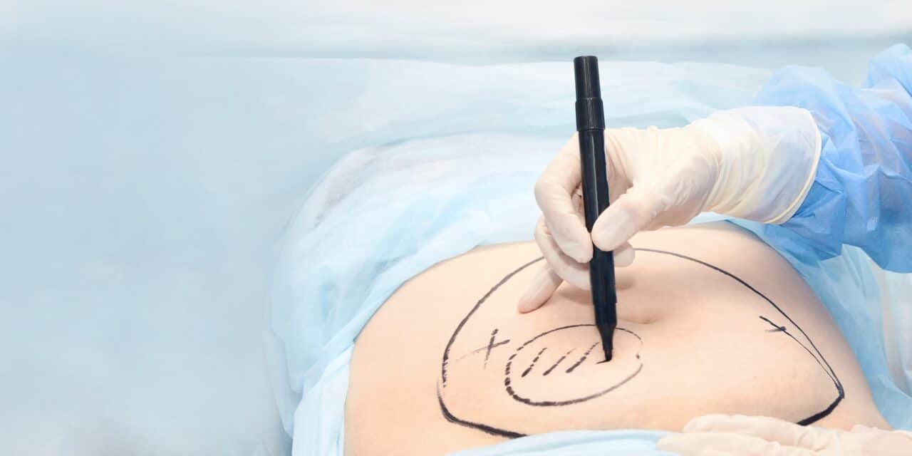 Doctors With Troubled Pasts Are Performing Cosmetic Surgeries Tied to Crippling Pain and Injury
