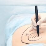 Doctors With Troubled Pasts Are Performing Cosmetic Surgeries Tied to Crippling Pain and Injury