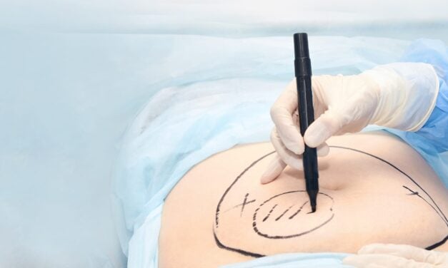 Doctors With Troubled Pasts Are Performing Cosmetic Surgeries Tied to Crippling Pain and Injury