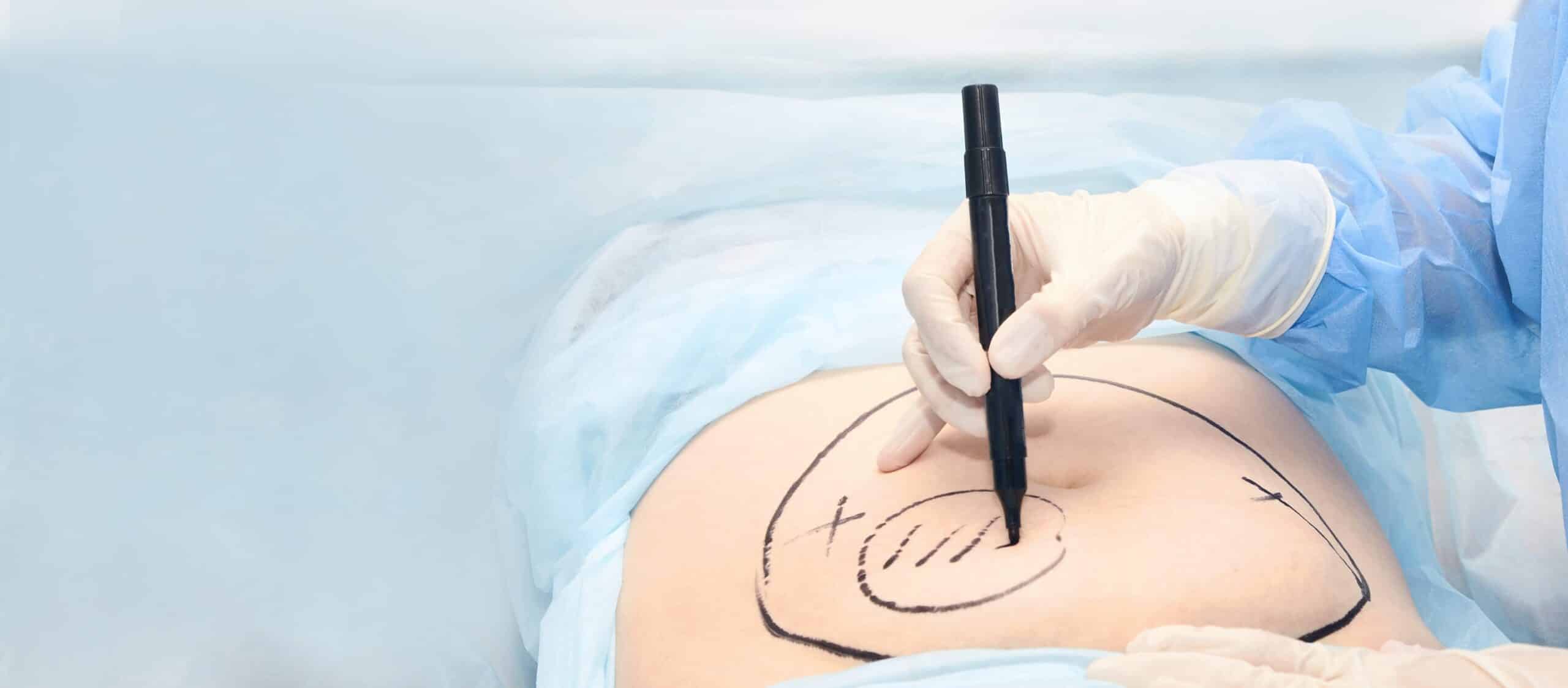 Doctors With Troubled Pasts Are Performing Cosmetic Surgeries Tied to ...