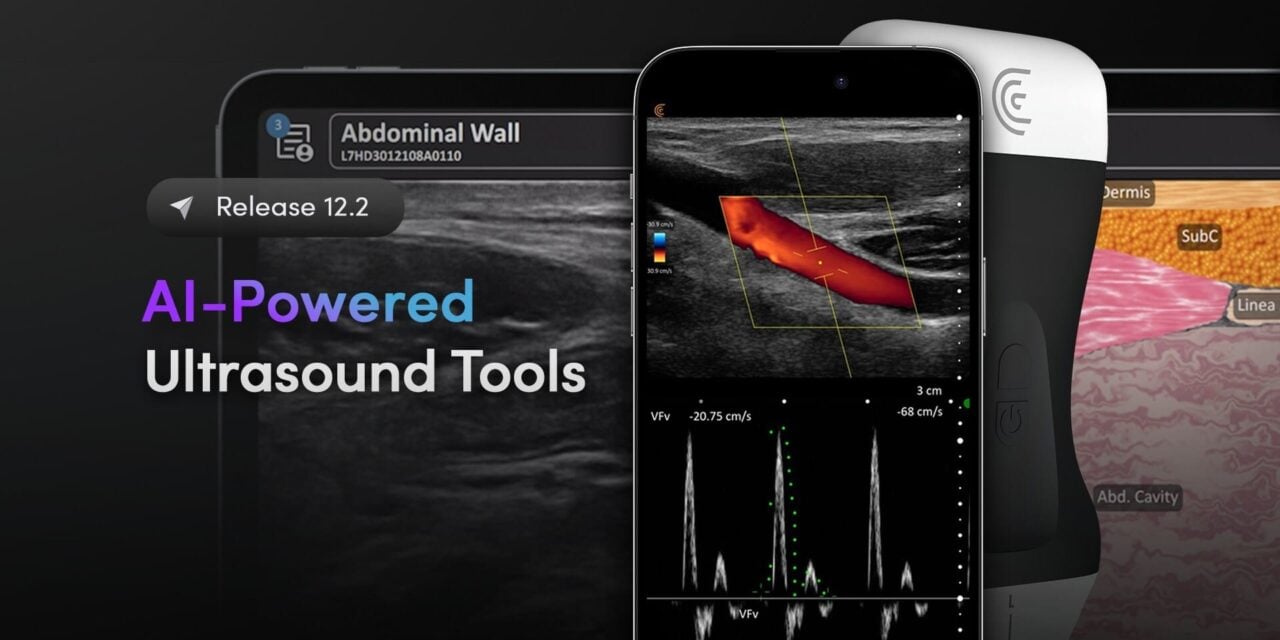 Clarius Updates App with AI-Powered Ultrasound Tools