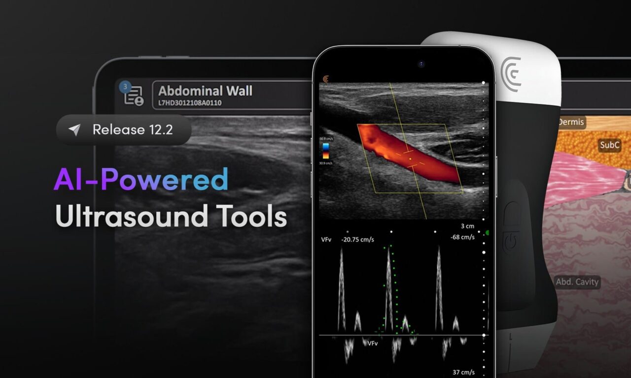 Clarius Updates App with AI-Powered Ultrasound Tools
