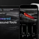 Clarius Updates App with AI-Powered Ultrasound Tools