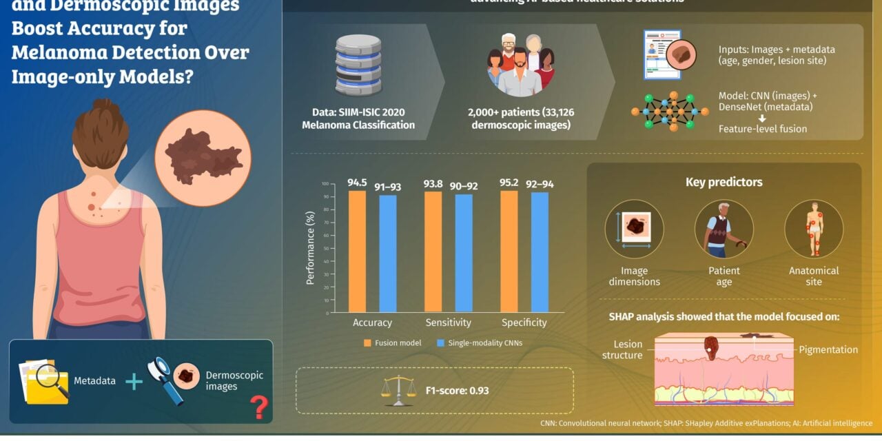 AI Model Identifies Melanoma With 94.5% Accuracy Using Images and Patient Data
