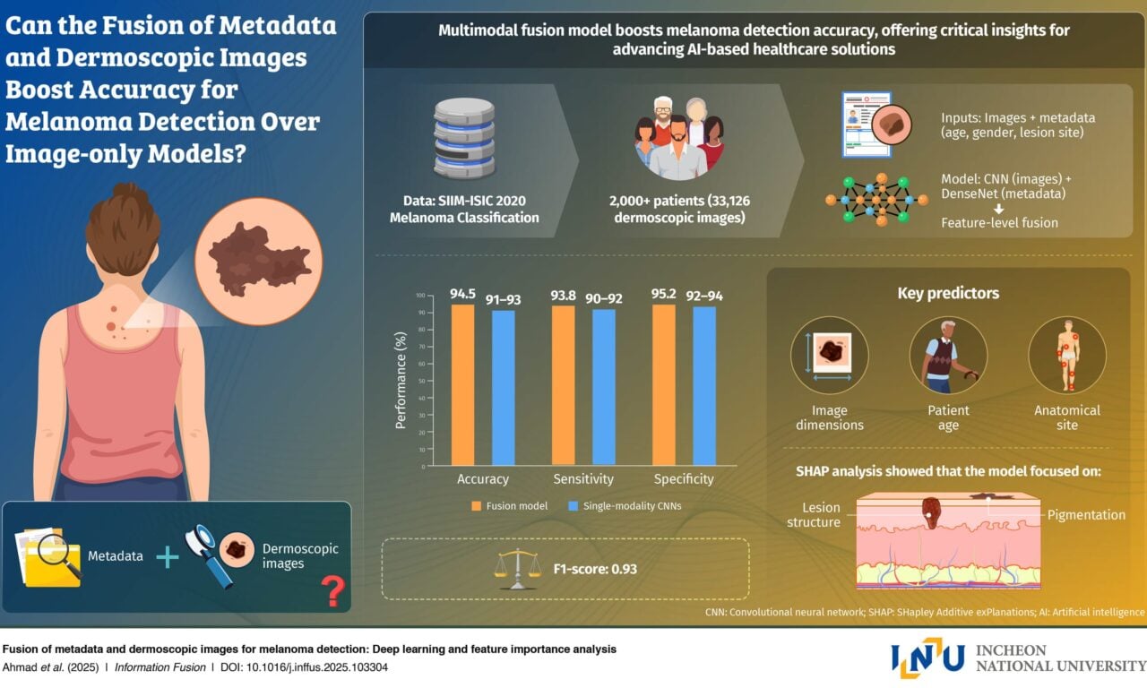 AI Model Identifies Melanoma With 94.5% Accuracy Using Images and Patient Data