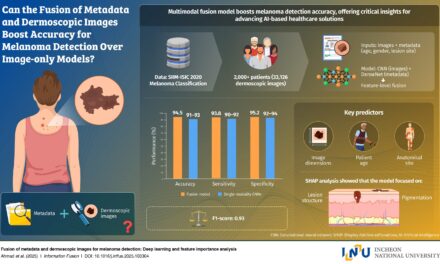 AI Model Identifies Melanoma With 94.5% Accuracy Using Images and Patient Data