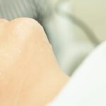 BENEV Partners with LaserAway to Expand Access to XTherma Device in the US