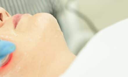 BENEV Partners with LaserAway to Expand Access to XTherma Device in the US