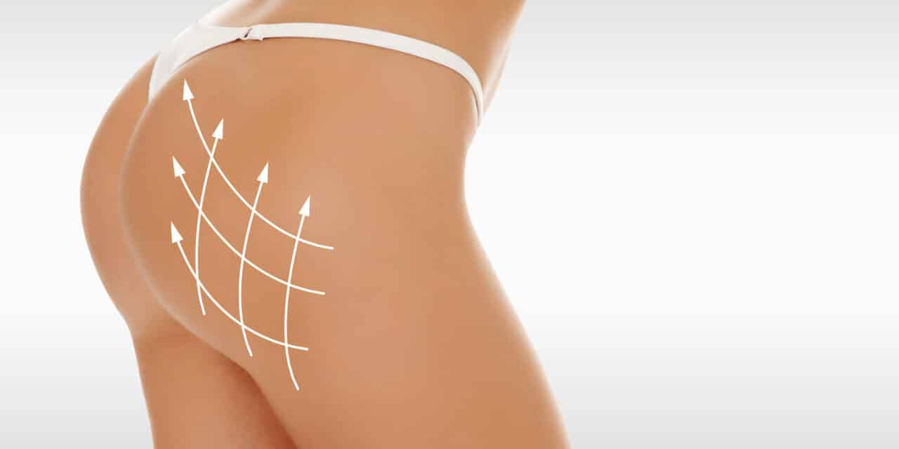 Why One Plastic Surgeon Believes Ultrasound-Guided BBLs Are the Future