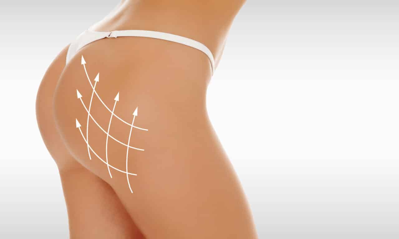 Why One Plastic Surgeon Believes Ultrasound-Guided BBLs Are the Future