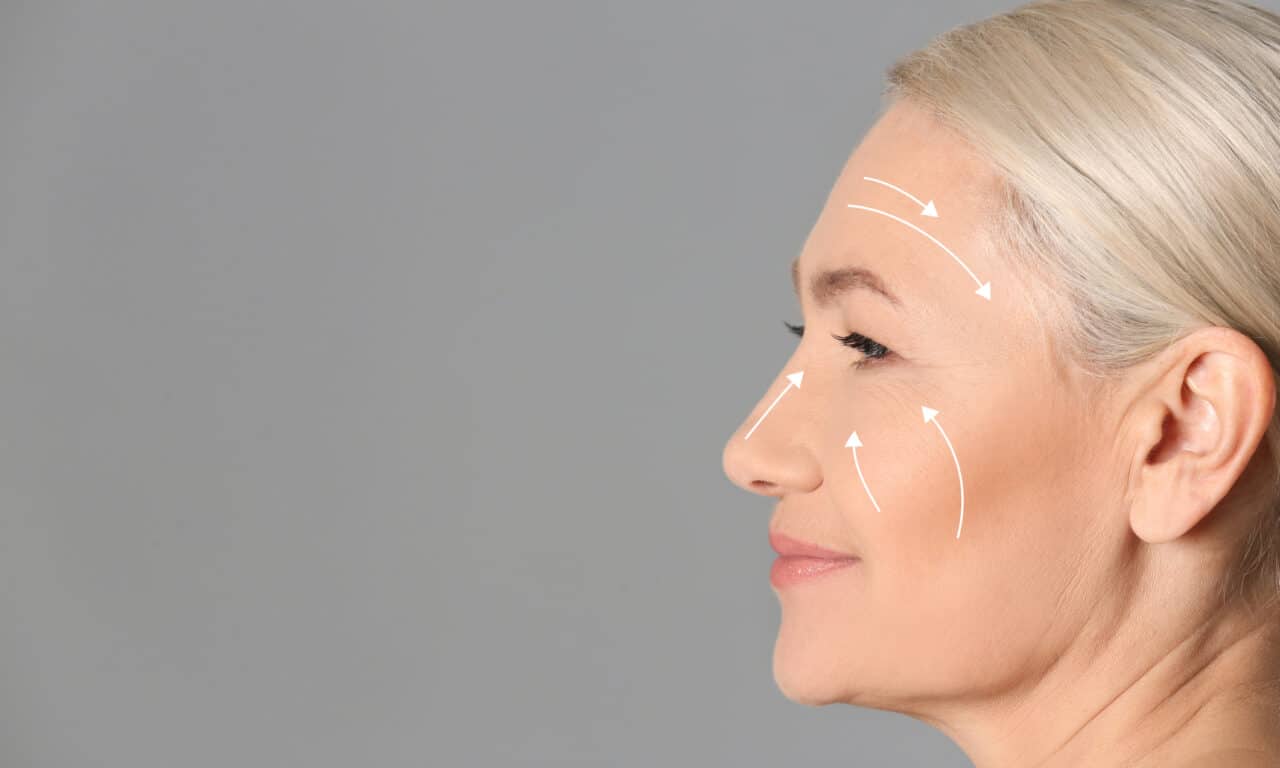 AAFPRS Notes Growing Patient Interest in Facelifts After Years of Filler