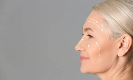 AAFPRS Notes Growing Patient Interest in Facelifts After Years of Filler