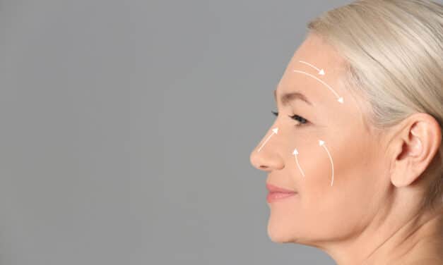 AAFPRS Notes Growing Patient Interest in Facelifts After Years of Filler