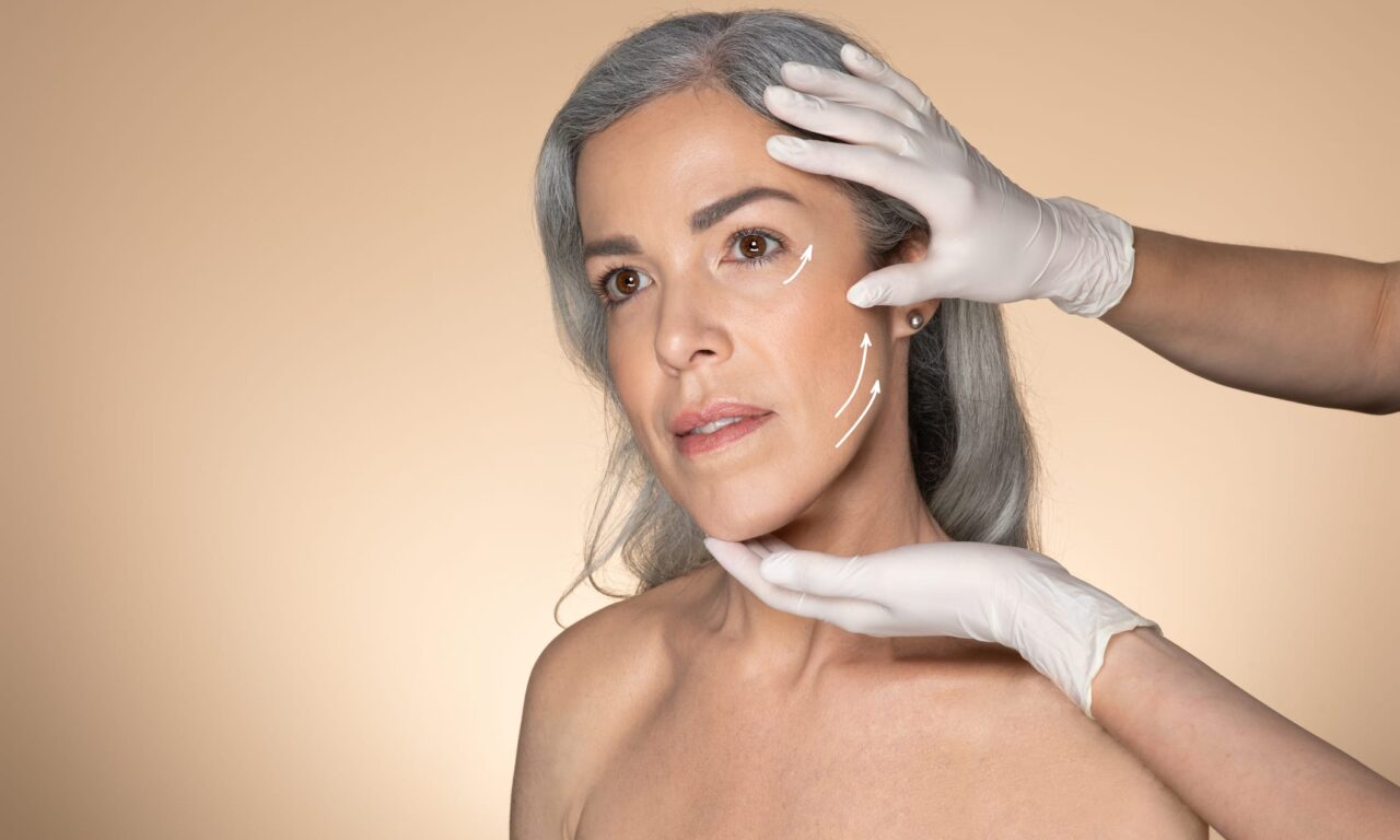 Can Deep Plasma Resurfacing and Facelifts Be Performed Together?