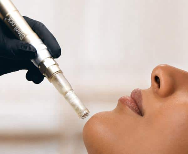 SkinHealth Systems Expands FDA-Cleared Indications for SkinStylus Microneedling Device