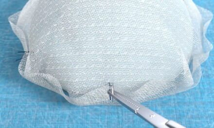 BD’s Breast Revision Trial for Capsular Contracture Reaches First Interim Analysis